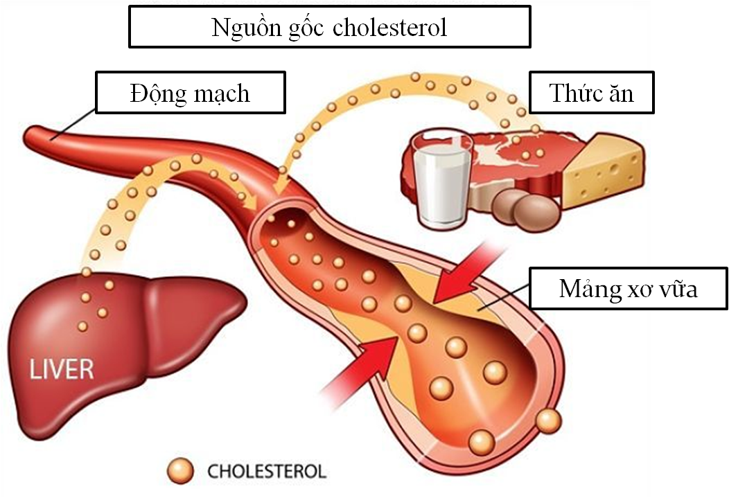 Rối loạn chuyển hóa Lipid máu-Nguyên nhân, điều trị cơ bản